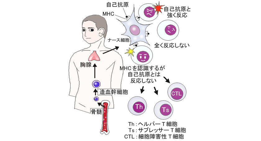 胸腺