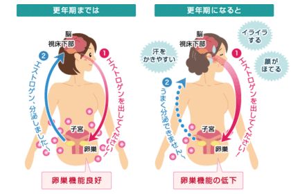 更年期