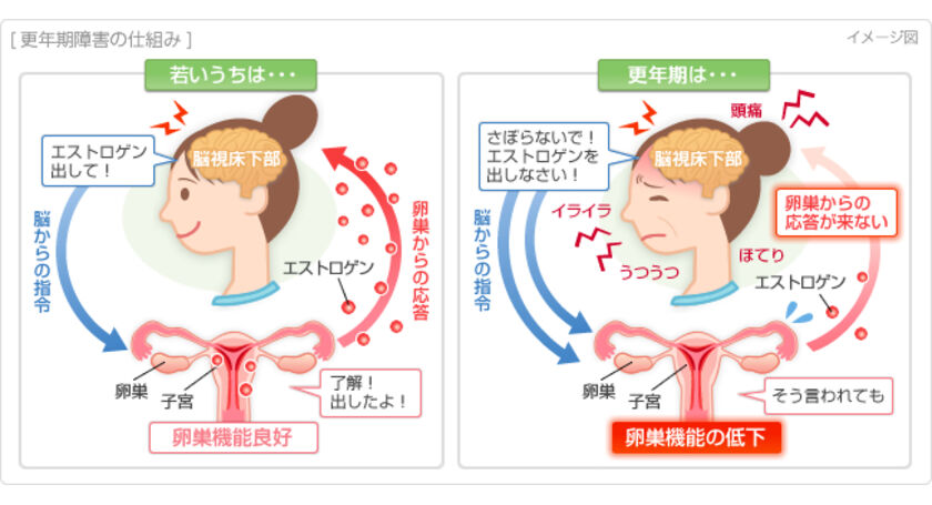 更年期