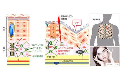 張り