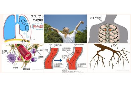 スジ