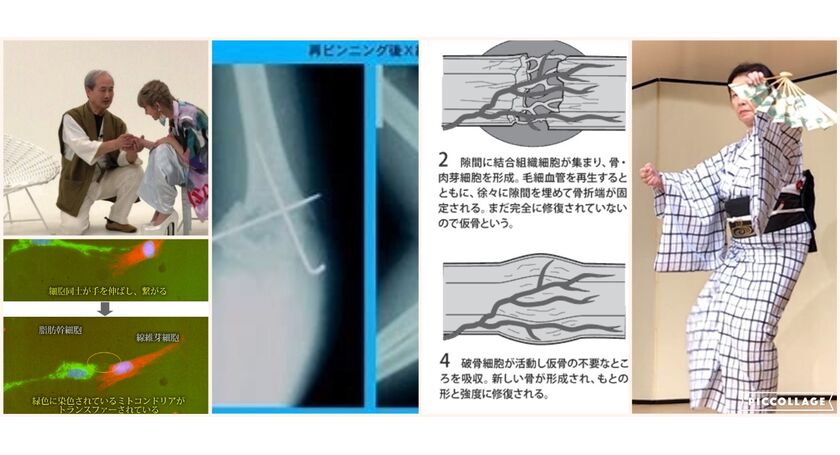 アロエ