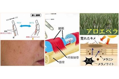 アロエ
