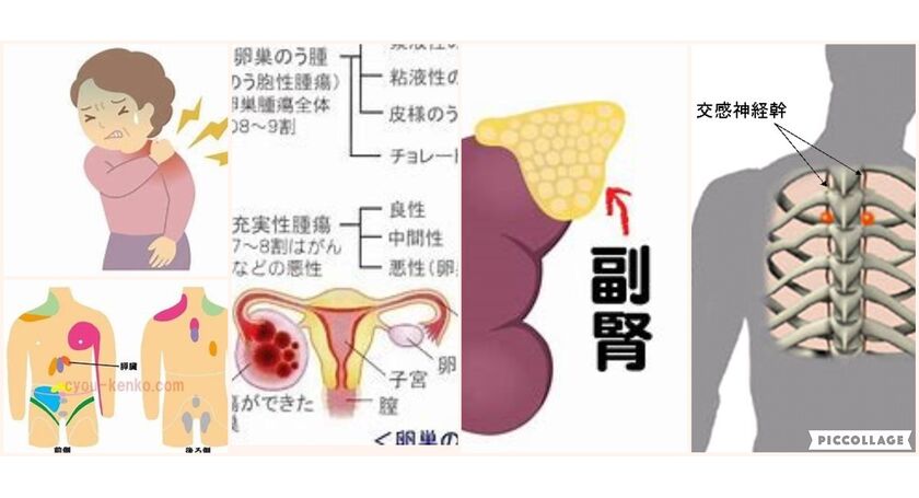 やはり卵巣の腫れと左肩の異常な痛みは関係あると思います 広尾の整体 天寿堂整復院のブログ