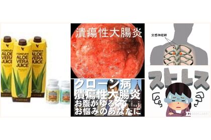 アロエ